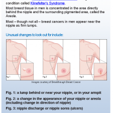 Signs and Symptoms - Be Breast Aware  #BBA
